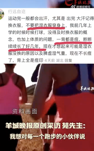 普惠配资 男子跑步后未擦汗感染马拉色菌：起了很多小疙瘩